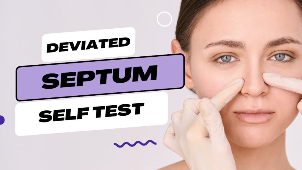Understanding and Testing for a Deviated Septum 86 Understanding and Testing for a Deviated Septum