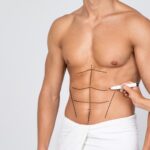 Mans Fit Torso With Surgical Lines On His Body Before Operation