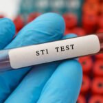 sti test800