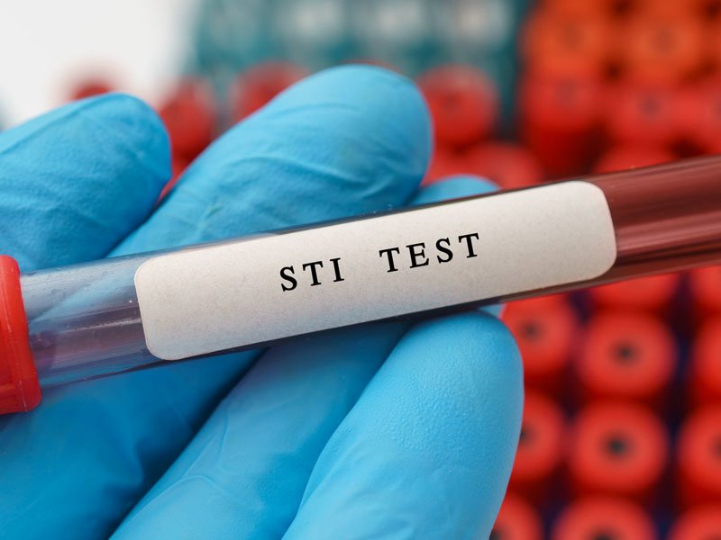 sti-test800
