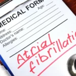 Will Atrial Fibrillation Affect My Travel Insurance