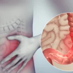 How FODMAPs Affect Digestive Health and IBD