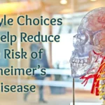 Learn How Lifestyle Choices Reduce Alzheimer's Risk