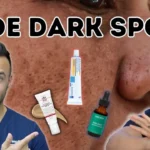 wellhealthorganic.com/easily-remove-dark-spots-lemon-juice
