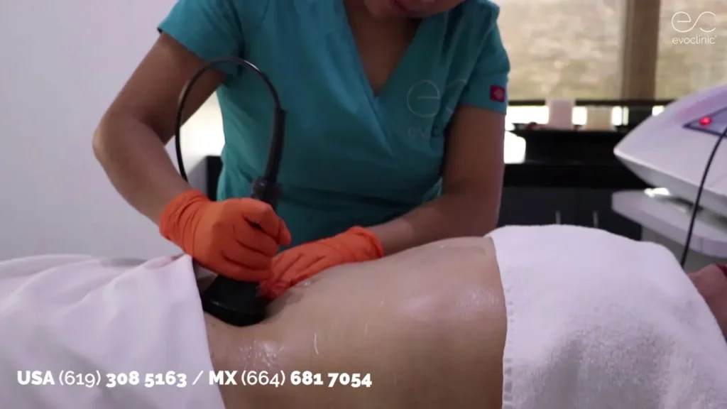 Como Debo Darme Los Masajes Con Maquina Lipolaser: How Should I Use the Lipo Laser Machine for Massages? 82 Como Debo Darme Los Masajes Con Maquina Lipolaser