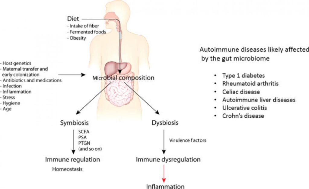 How Your Microbiome Affects Autoimmune Disorders 